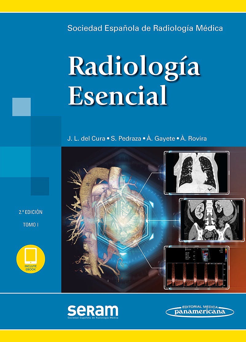 Radiología Esencial