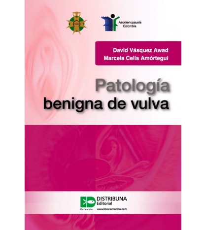 Patología Benigna De Vulva