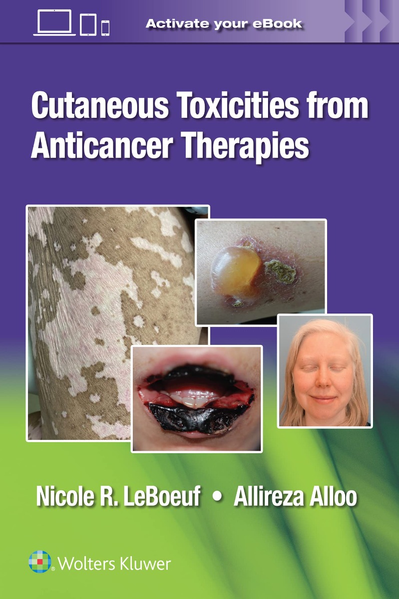 Cutaneous Reactions to AntiCancer Therapies