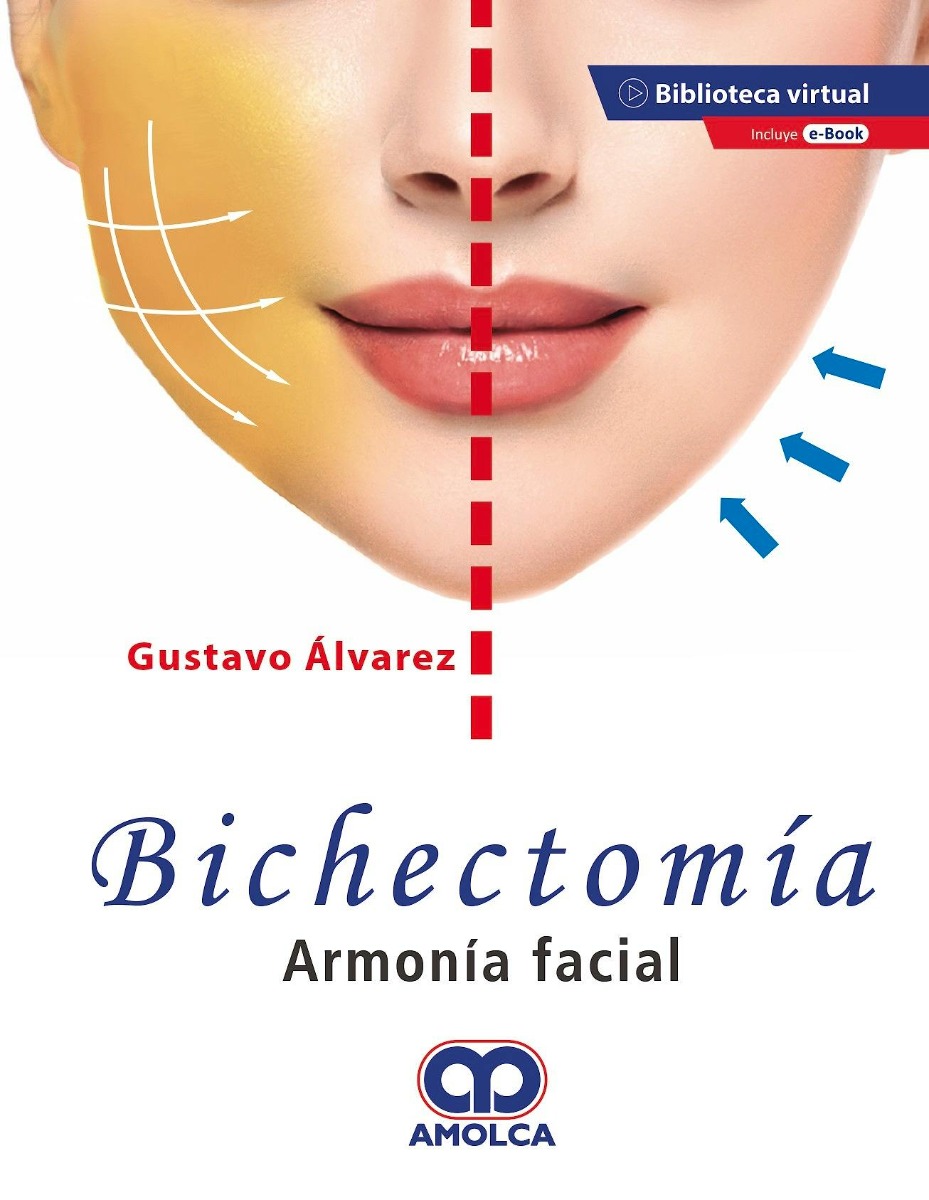 Bichectomía. Armonía Facial