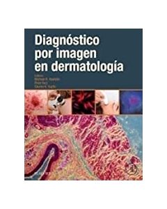 Diagnóstico Por Imagen En Dermatología