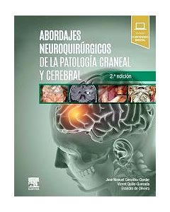 Abordajes Neuroquirúrgicos De La Patología Craneal Y Cerebral + Acceso Online