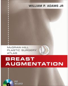 Breast Augmentation