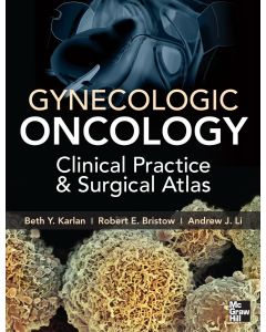 Gynecologic Oncology