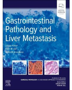 Gastrointestinal Pathology and Liver Metastasis