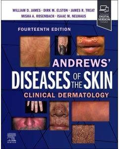 ANDREWS' Diseases of the Skin. Clinical Dermatology