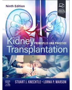 Kidney Transplantation. Principles And Practice