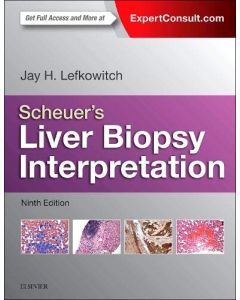 Scheuer's Liver Biopsy Interpretation