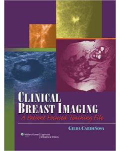 Clinical Breast Imaging: A Patient Focused Teaching File 1St Edición