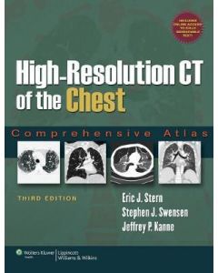 High-Resolution Ct Of The Chest 3Ed