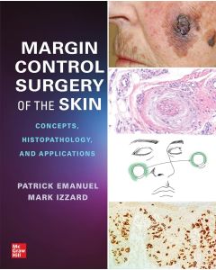 Margin Control Surgery of the Skin