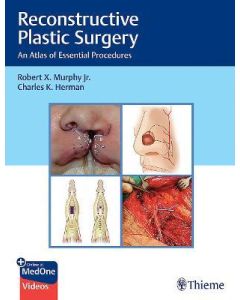 Reconstructive Plastic Surgery: An Atlas Of Essential Procedures 1St Edición, Edición Kindle