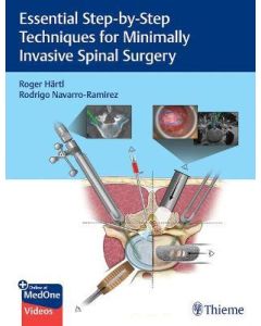 Essential Step-By-Step Techniques For Minimally Invasive Spinal Surgery 1St Edición