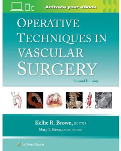 Operative Techniques in Vascular Surgery