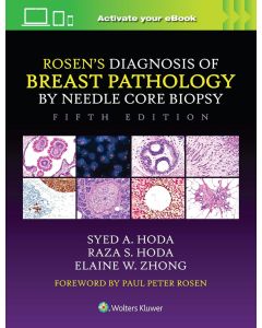 ROSEN's Diagnosis of Breast Pathology by Needle Core Biopsy