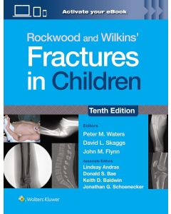 Rockwood and Wilkins' Fractures in Children: Print + eBook with Multimedia