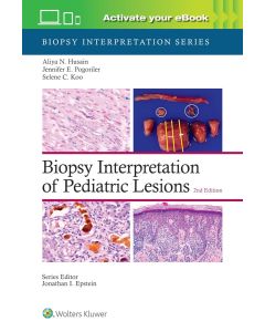 Biopsy Interpretation of Pediatric Lesions