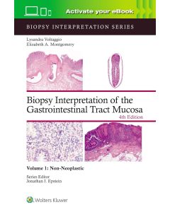 Biopsy Interpretation of the Gastrointestinal Tract Mucosa Volume 1