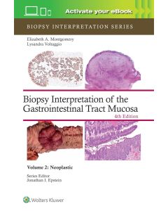 Biopsy Interpretation of the Gastrointestinal Tract Mucosa Volume 2