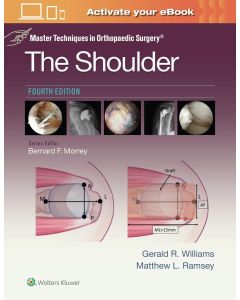 Master Techniques in Orthopaedic Surgery: The Shoulder