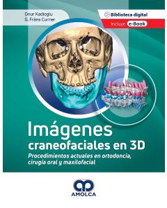 Imágenes Craneofaciales en 3D