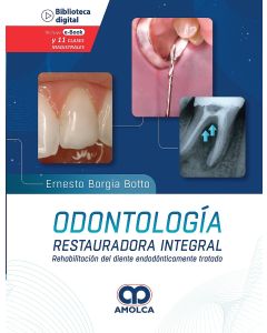 Odontología Restauradora Integral