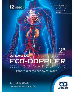 Atlas de Eco-Doppler Color Vascular. Procedimientos Endovasculares