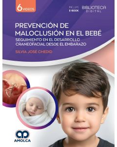 Prevención de Maloclusión en el Bebé. Seguimiento en el Desarrollo Craneofacial desde el Embarazo