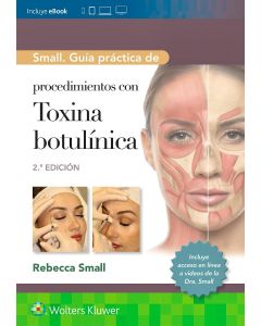 Small. Guía práctica de procedimientos con toxina botulínica