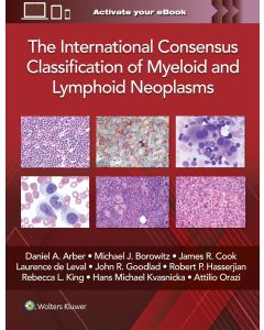 The International Consensus Classification of Myeloid and Lymphoid Neoplasms