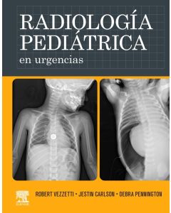 Radiología pediátrica en urgencias
