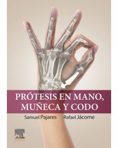 Prótesis en Mano, Muñeca y Codo