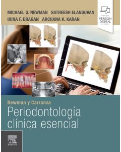 NEWMAN y CARRANZA Periodontología Clínica Esencial