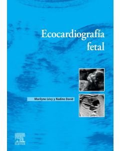 Ecocardiografía fetal 1ª
