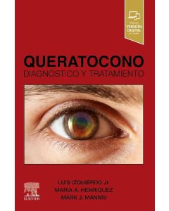 Queratocono. Diagnóstico y Tratamiento