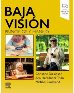 Baja Visión. Principios y Manejo