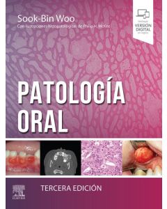 Patología Oral 3ª