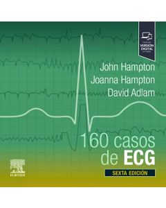 160 Casos de ECG