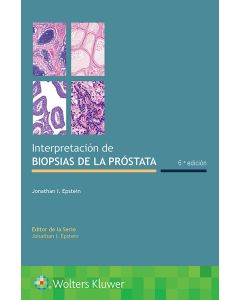 Interpretación De Biopsias De La Próstata.