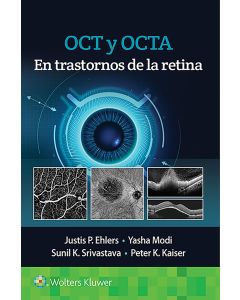 OCT y OCTA en Trastornos de la Retina