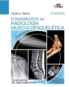 Fundamentos De Radiología Musculoesquelética