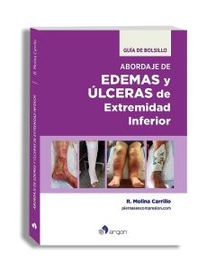 Abordaje de Edemas y Úlceras de Extremidad Inferior