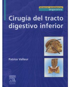 Cirugía Del Tracto Digestivo Inferior