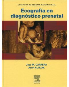 Ecografía En Diagnóstico Prenatal