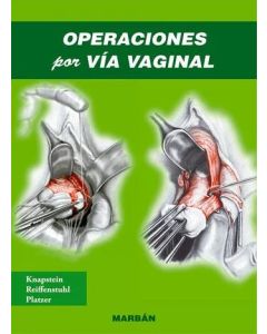 Operaciones por Vía Vaginal