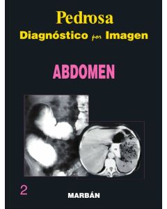 Diagnóstico por Imagen, Vol. 2 Abdomen