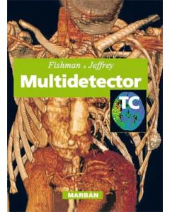 Multidetector TC