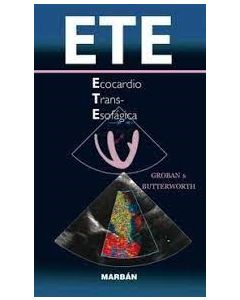  ETE Ecocardio Trans-Esofagica