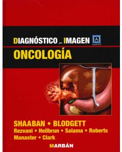 Diagnóstico por Imagen Oncología