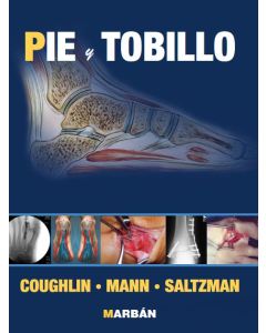 Cirugia de Pie y Tobillo